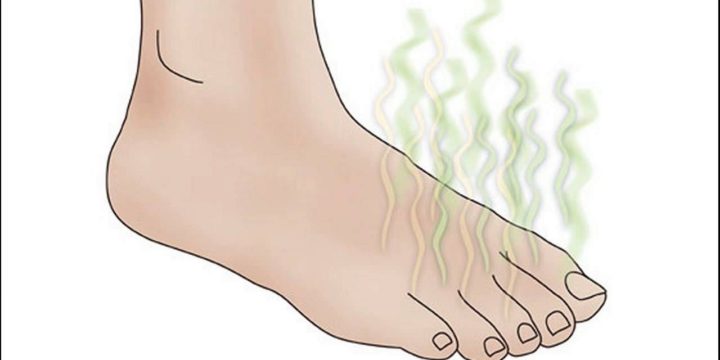 Smelly feet: What causes this and how can I prevent it?